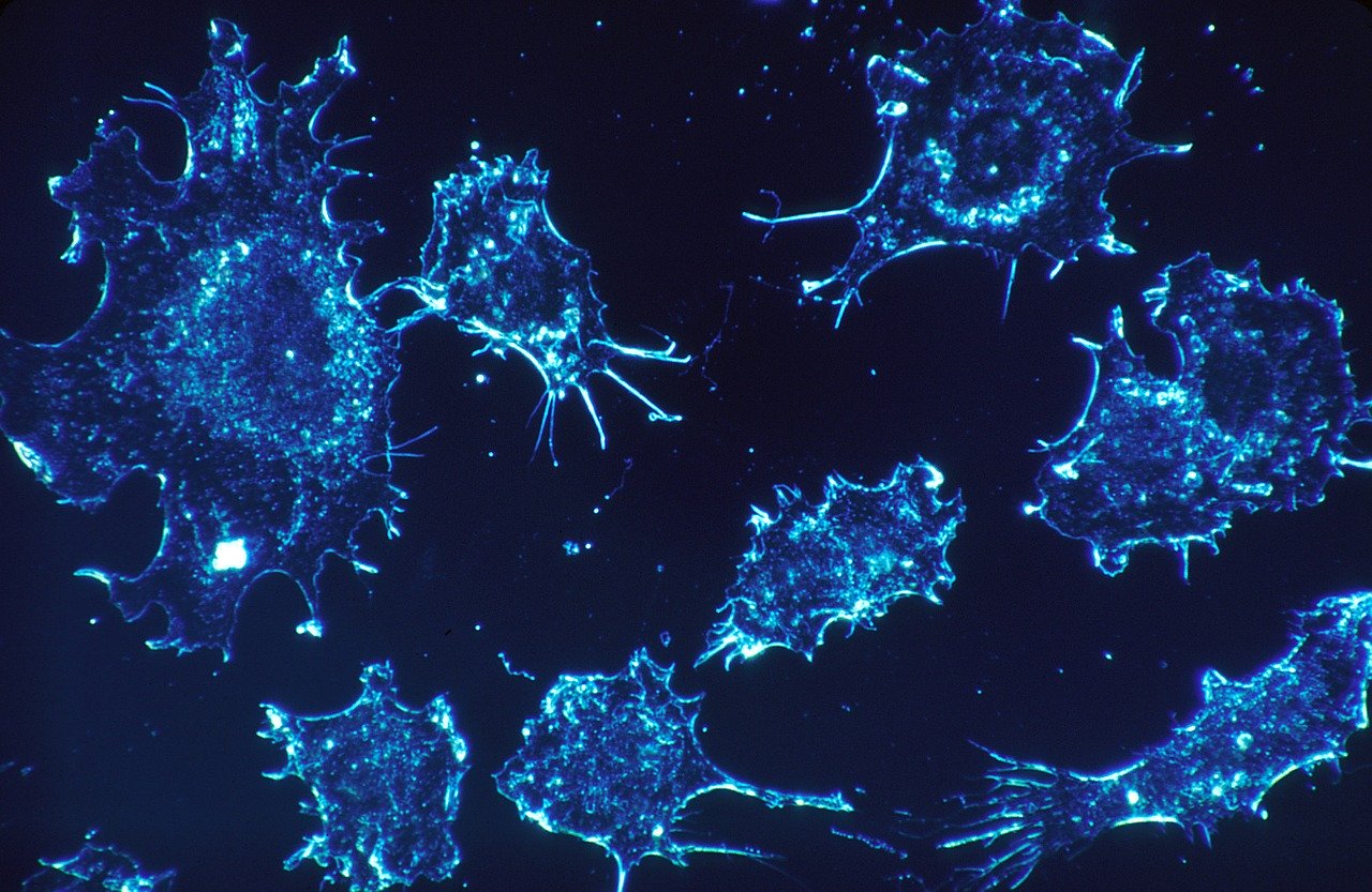 Photo of cancer cells.