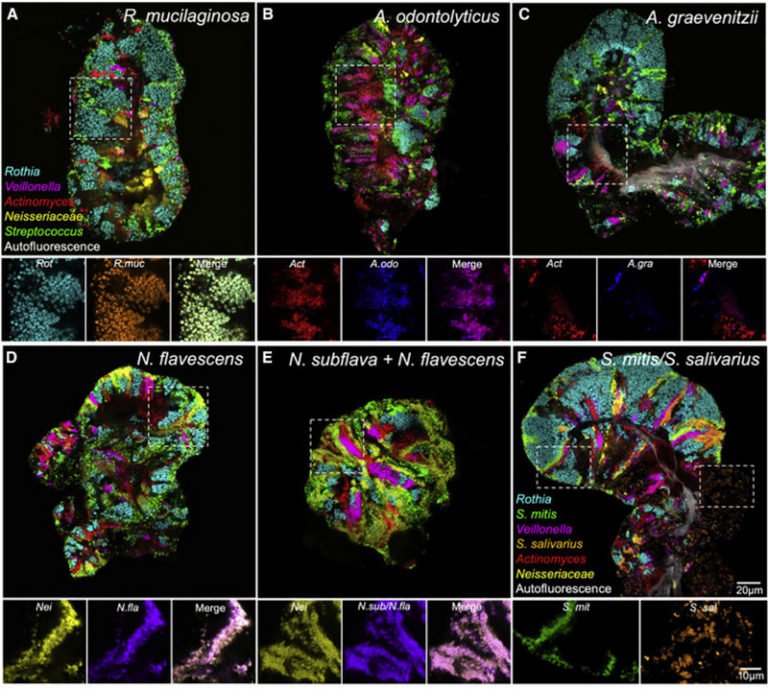 Your tongue is an absolute bacterial zoo!