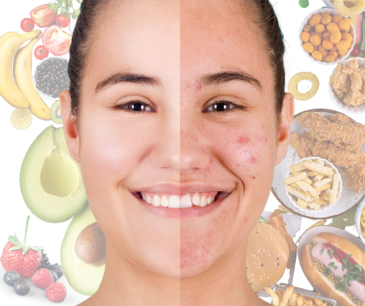 Proper nutrition nourishes skin, enhancing elasticity, reducing inflammation, and improving luminosity, while inadequate diet causes dullness, dryness, acne, and premature aging.