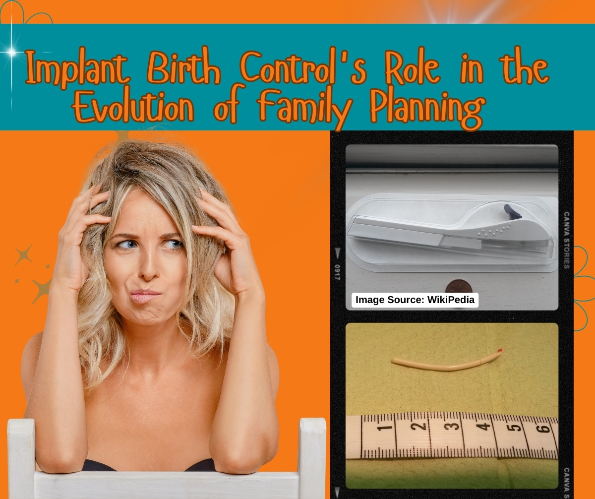 Implant Birth Control's Role in the Evolution of Family Planning